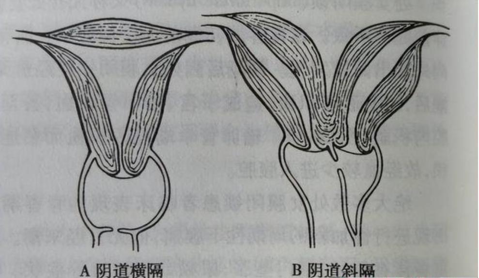 人到晚年忆苦思甜屈曲成圆日月形五体投地皆打一生肖，详细解答、构建解答解释落实